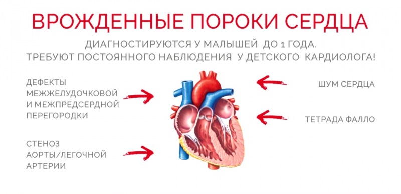 Врожденные пороки сердца - классификация