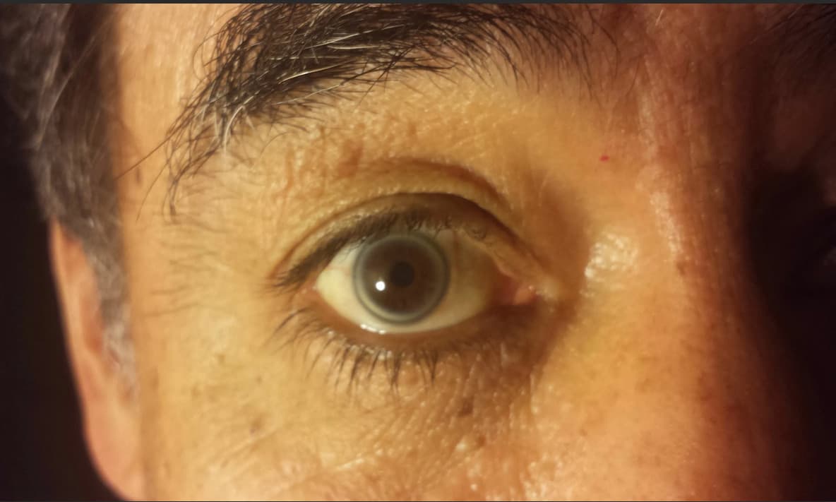 Черные точки в глазах: причины, диагностика и лечение