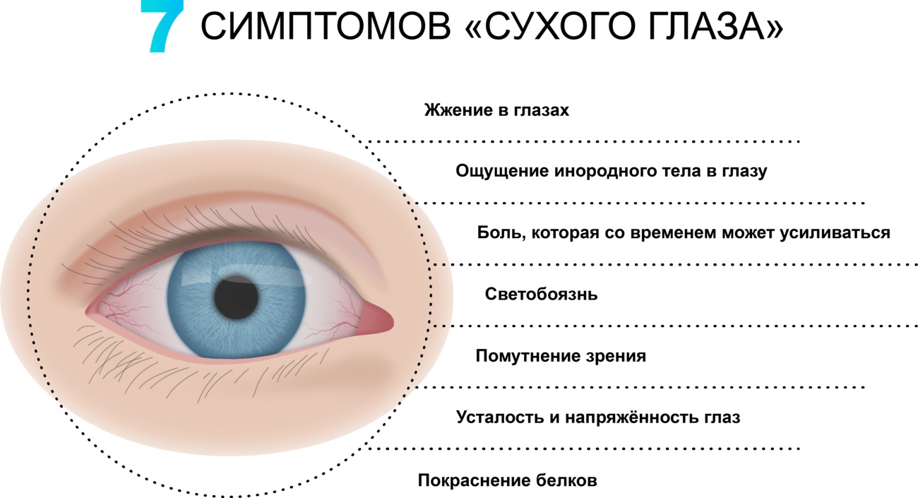 Симптомы сухого глаза