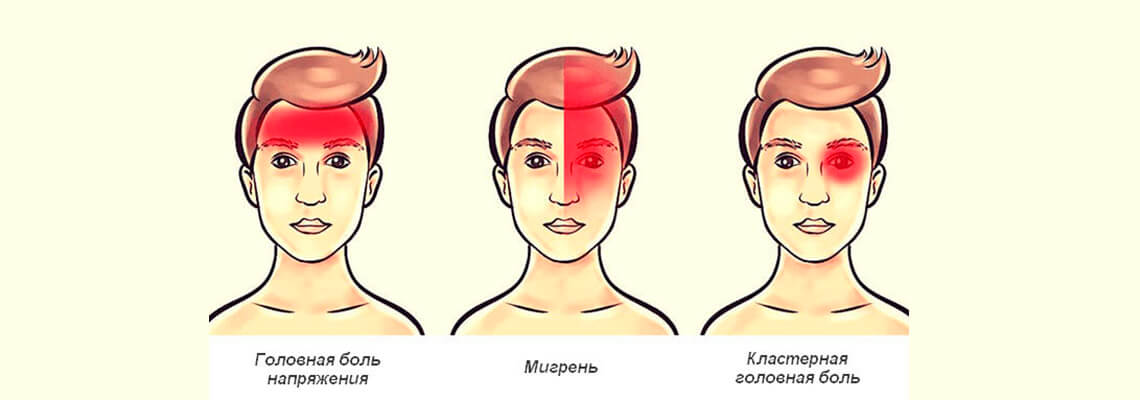 Может ли при мигрени повышаться давление? | «ЗдравКлиник» - клиника неврологии и ортопедии