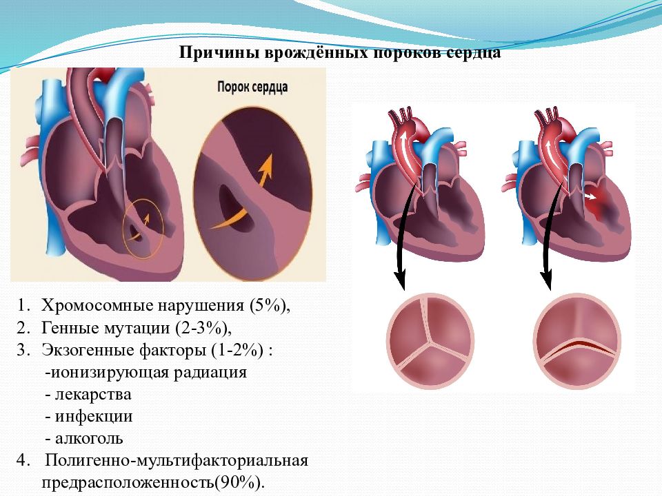 Причины развития врожденных пороков сердца