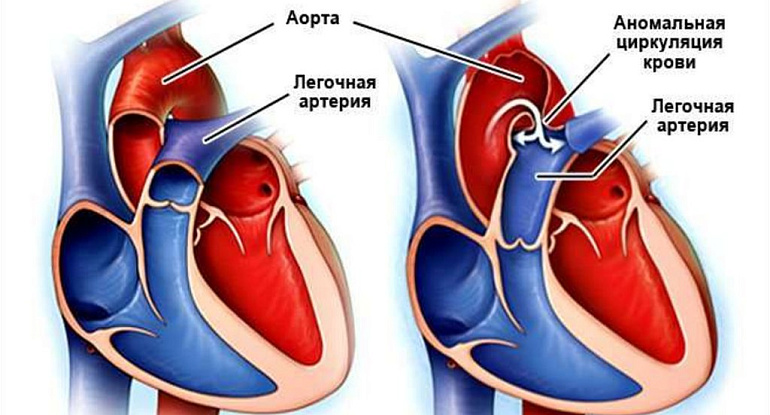 Почему сердце не устает: основные факторы и влияние на здоровье