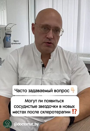 Могут ли появиться сосудистые звездочки в новых местах после склеротерапии? #shorts